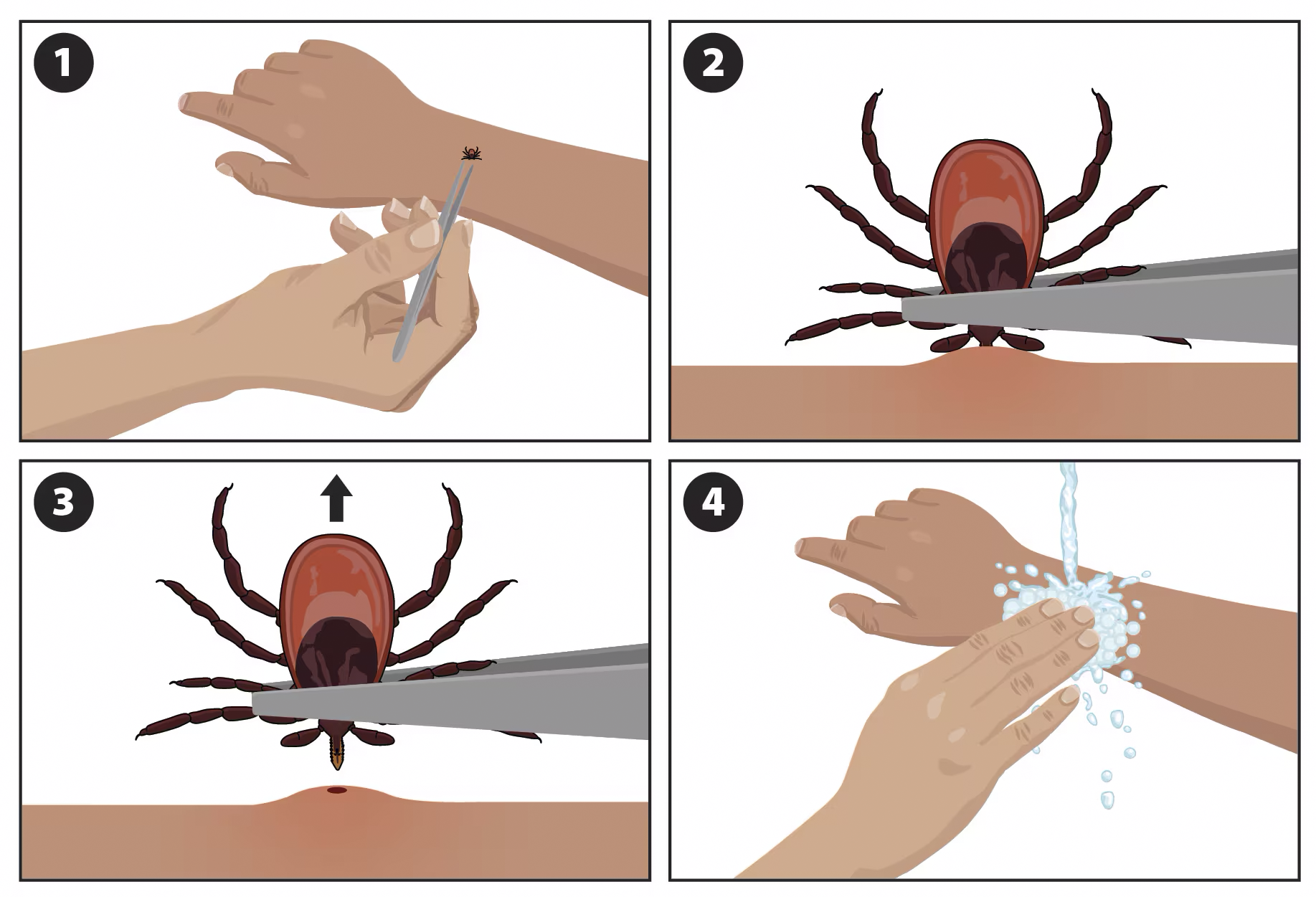 Visual reflecting the 4 steps of how to remove a tick. 